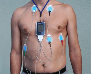 Holter Monitoring test